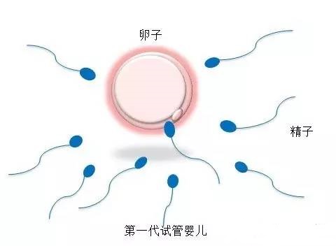 培养箱